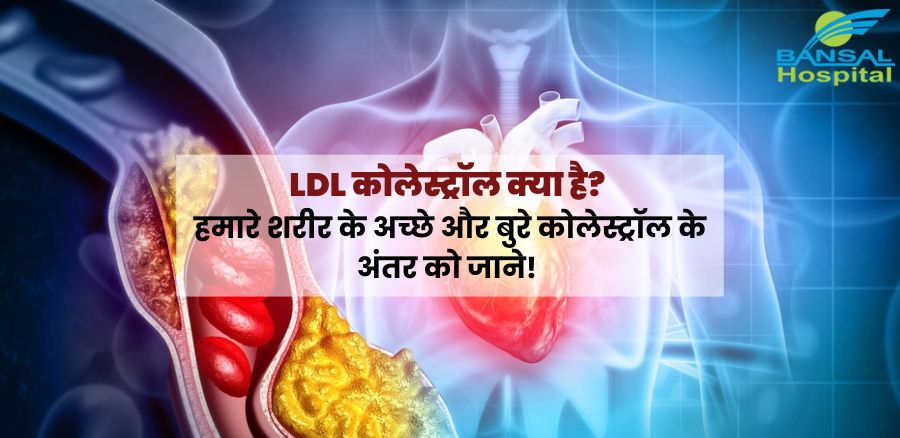 LDL कोलेस्ट्रॉल की जांच और निदान